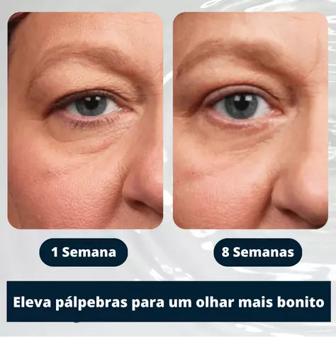 Derma Lift - Pálbebras Firmes e Elevadas com Efeito Permanente