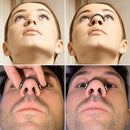 Anti Ronco Magnético